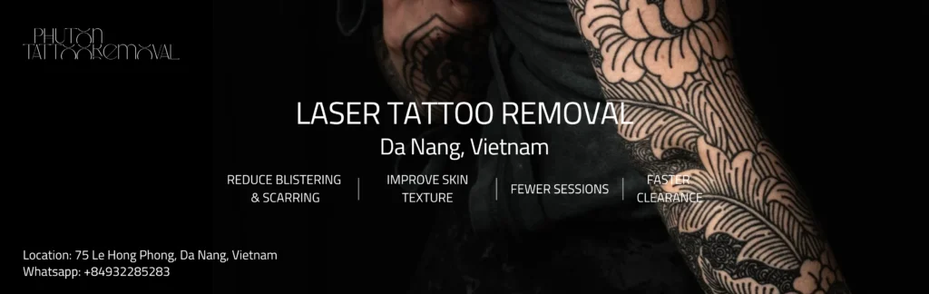 tattoo removal da nang