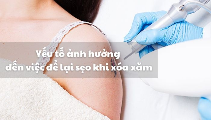 Các yếu tố ảnh hưởng đến việc để lại sẹo khi xóa xăm