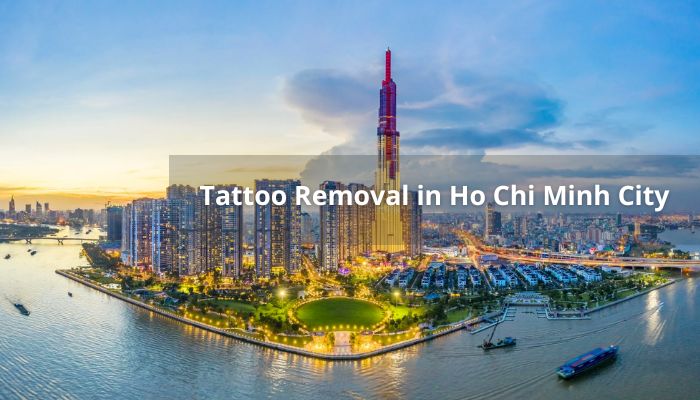What to Look for in a Tattoo Removal Clinic in Ho Chi Minh City