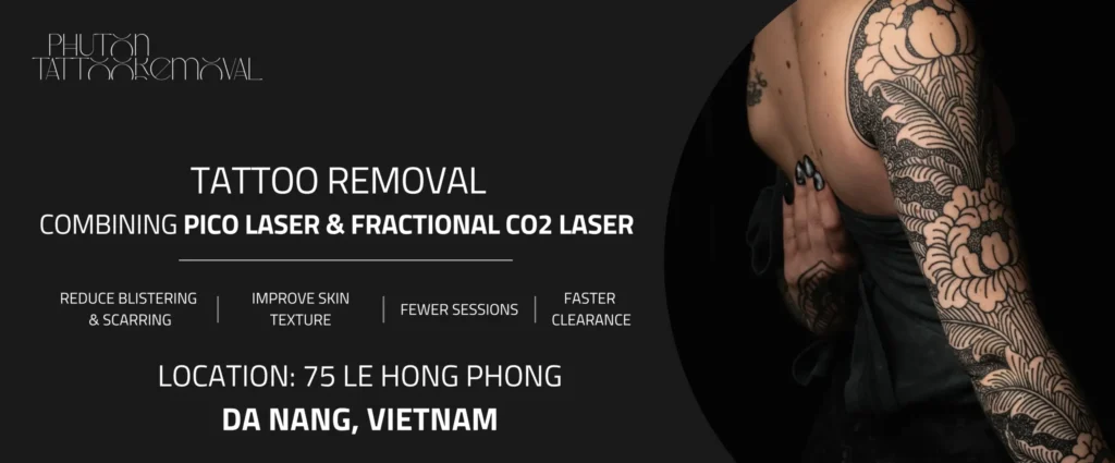 tattoo removal ho chi minh
